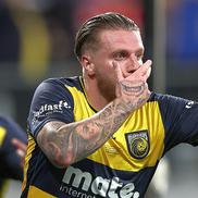 Jason Cummings și gura pe care a vrut-o tatuată pe mâna dreaptă / foto: Guliver gettyimages