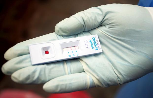 Strigător la cer » Federația din Brazilia a lăsat 4 fotbaliști infectați cu coronavirus să joace