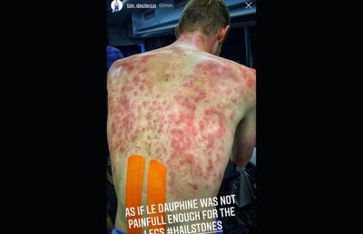 HORROR » O furtună cu gheață a lovit cursa ciclistă Criterium du Dauphine, iar unii cicliști au suferit răni severe