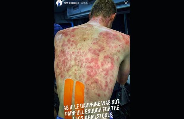 HORROR » O furtună cu gheață a lovit cursa ciclistă Criterium du Dauphine, iar unii cicliști au suferit răni severe