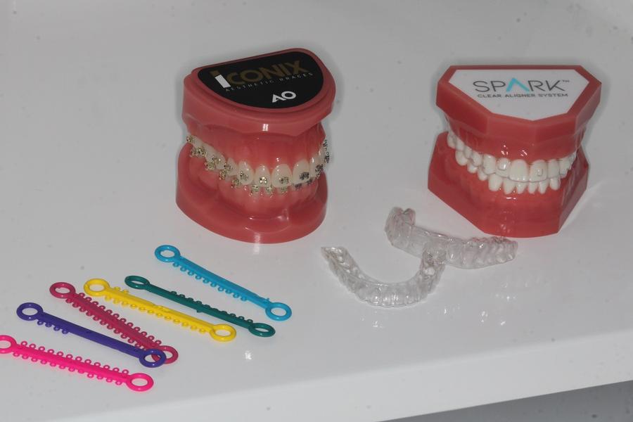 Se poate purta aparat dentar invizibil dacă faci sport? Ce le recomandă adulților activi medicii ortodonți de la Dental Science, București