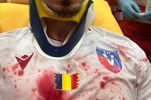 Ajuns direct la spital, după o lovitură teribilă, Dragoș Huiban a fost șocat de reacția arbitrului: „Știți ce mi-a spus?!”