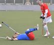 Fotbal pentru amputați, FCSB - Dinamo