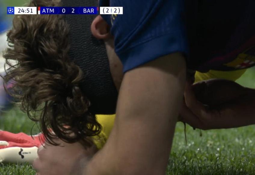 FOTO înfricoșător cu accidentarea suferită de Fermin Lopez // captură X