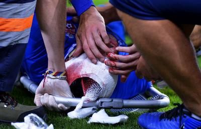 DINAMO - FC BOTOȘANI 1-1 // UPDATE+FOTO Ce diagnostic i-au pus medicii lui Moussa după ciocnirea cu Pap » Atenție, imagini dure cu accidentarea!