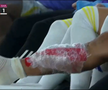 Accidentarea Florinel Coman în Al Arabi - Al Gharafa / Foto: X