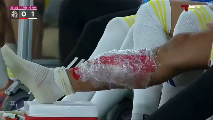 Accidentarea Florinel Coman în Al Arabi - Al Gharafa / Foto: X