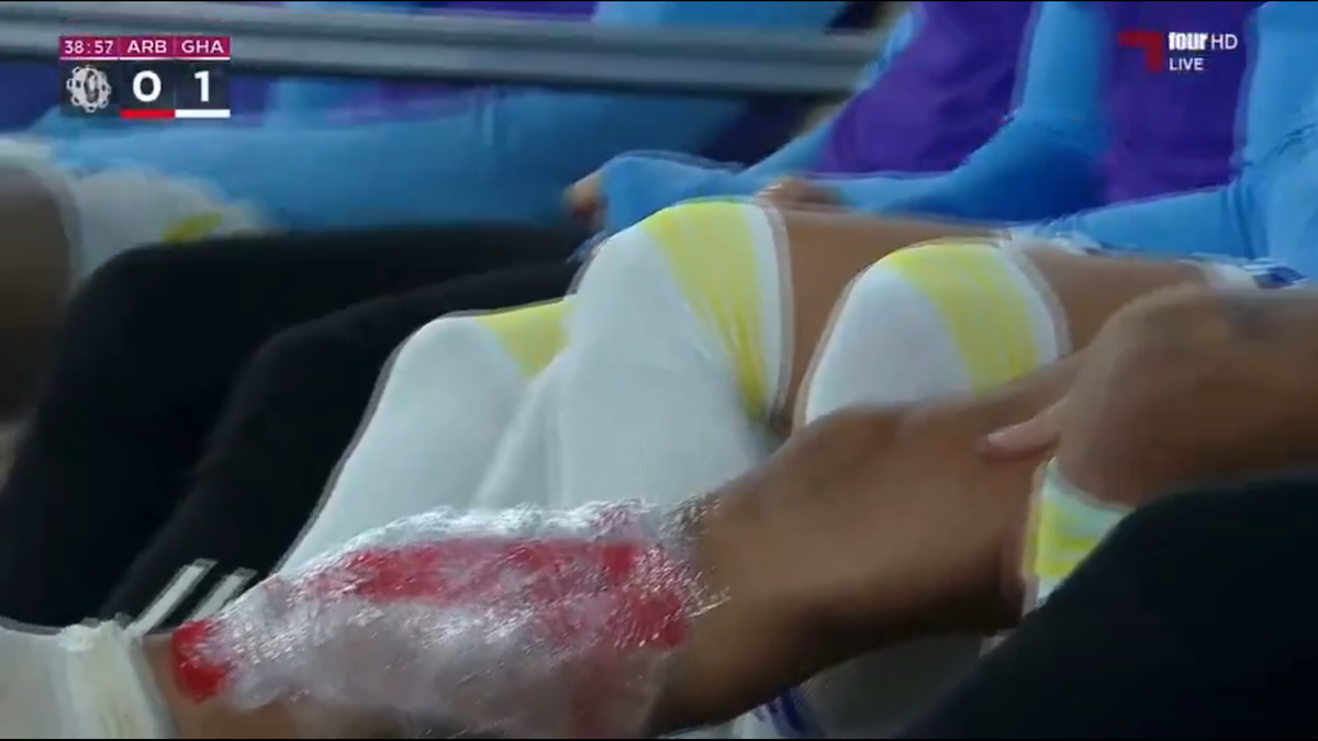 Piciorul lui Florinel Coman după accidentarea din Al Arabi - Al Gharafa