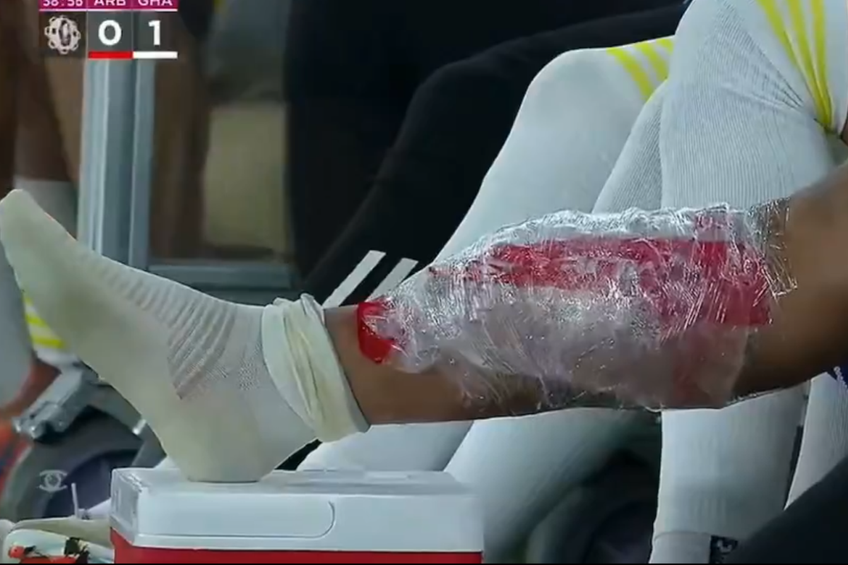 Piciorul lui Florinel Coman, accidentat în Al Arabi - Al Gharafa / Foto: captură de ecran Twitter