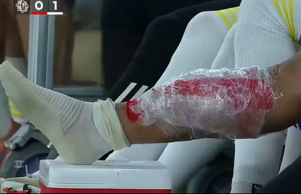 Florinel Coman s-a accidentat în duelul cu echipa lui Cosmin Contra » Exces de zel al arbitrului