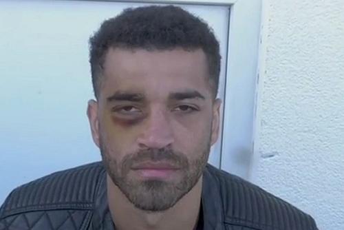 Așa arată ochiul lui Sam Maxwell
