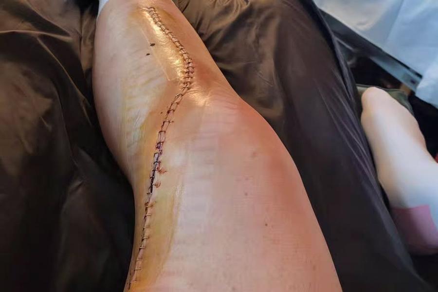 Federica Brignone s-a întors la antrenamente după 8 luni de la o gravă accidentare