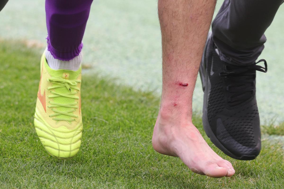 Bogdan Andone a dat diagnosticul pentru Yanis Pîrvu, după accidentarea horror de la Voluntari