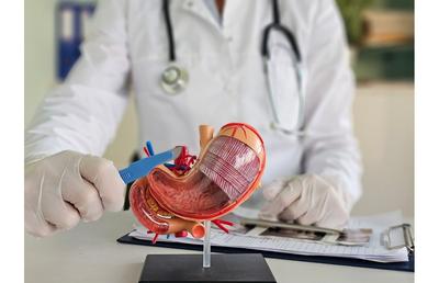 3 beneficii ale operației de micșorare a stomacului (gastric sleeve)