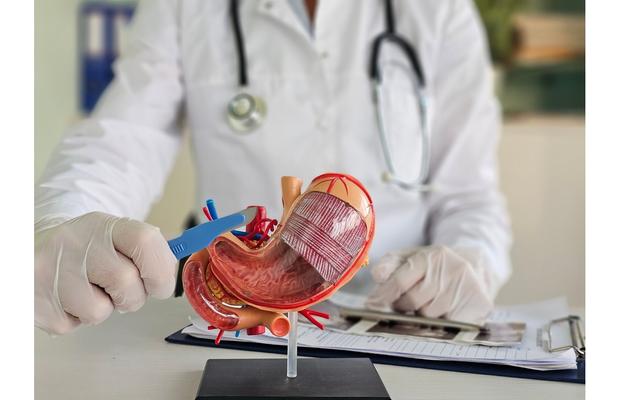 3 beneficii ale operației de micșorare a stomacului (gastric sleeve)