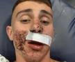 Un luptător olimpic de taekwondo, lăsat într-o baie de sânge pe stradă! Atenție, imagini șocante