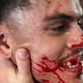 Quiermo Dumay, bătut cu bestialitate de Jhon van Beukering, antrenorul secund al fostei sale echipe // foto: captură bild.de