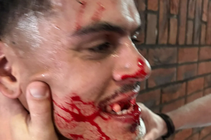 Caz șocant: Jucător bătut cu bestialitate de fostul antrenor » Meciul a fost abandonat, iar clubul a depus o plângere la poliție