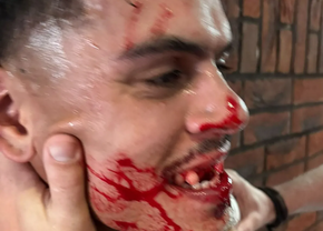 Caz șocant: Jucător bătut cu bestialitate de fostul antrenor » Meciul a fost abandonat, iar clubul a depus o plângere la poliție