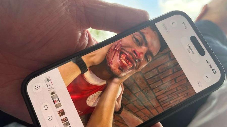 Quiermo Dumay, bătut cu bestialitate de Jhon van Beukering, antrenorul secund al fostei sale echipe // foto: captură debunschoter-online.nl Fotbalist desfigurat de antrenorul advers! » Meciul a fost abandonat, iar clubul a depus o plângere la poliție
