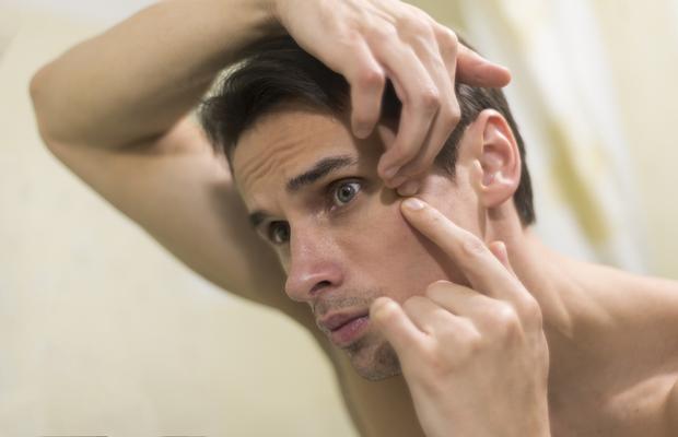 Acneea: tipuri, cauze, tratament și prevenție