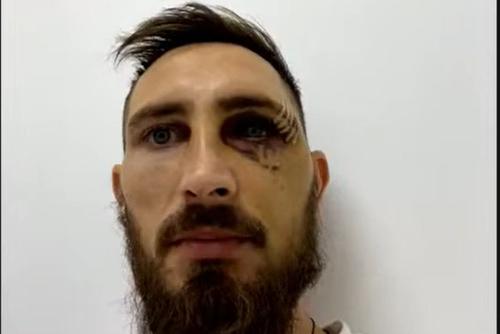 Bogdan Rusu (31 de ani), golgeterul lui CS Mioveni, va fi indisponibil o lună și jumătate după ce a fost accidentat de portarul Mihai Eșanu (23) în amicalul din urmă cu 4 zile cu Dinamo, 0-2.