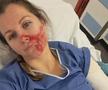 Ania Monica Caill s-a accidentat în timpul unui antrenament, foto: facebook Ania Monica Caill