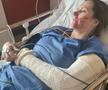 Ania Monica Caill s-a accidentat în timpul unui antrenament, foto: facebook Ania Monica Caill