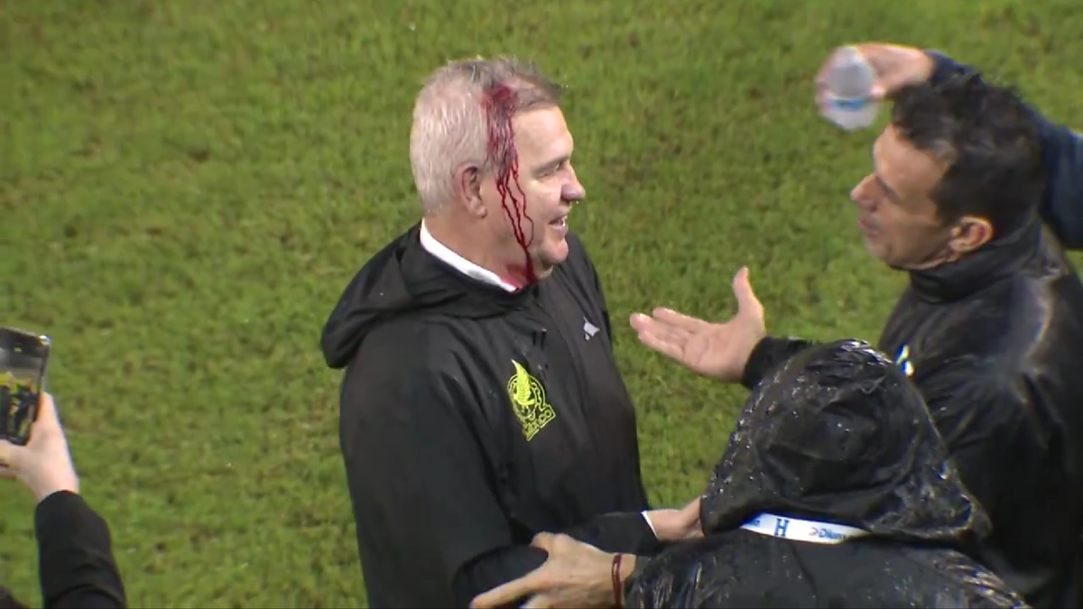 Javier Aguirre, umplut de sânge după ce a fost lovit în cap de o doză de bere în Honduras - Mexic