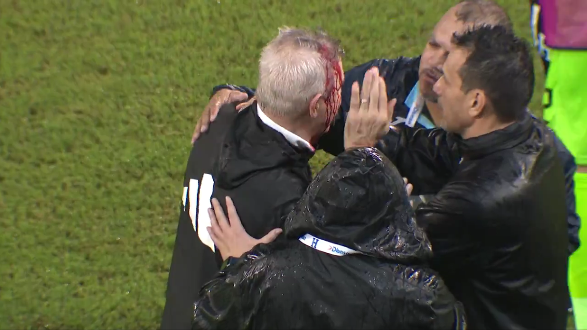 Javier Aguirre, umplut de sânge după ce a fost lovit în cap de o doză de bere în Honduras - Mexic