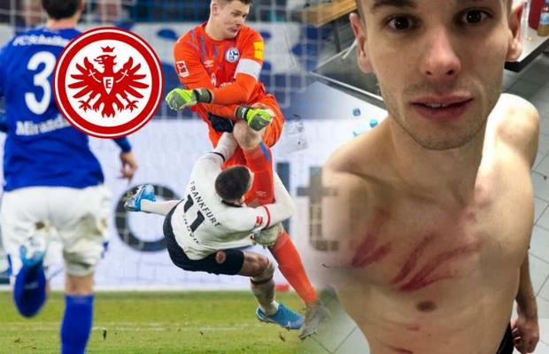 Schalke - Frankfurt 1-0 // Mijat Gaćinovic, contuzii severe la coaste după cel mai brutal fault al anului: „Nübel merită măcar 6 etape!”