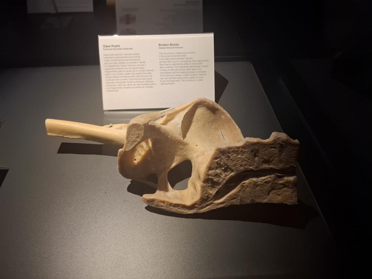 Expoziția Body Worlds Vitals de la București