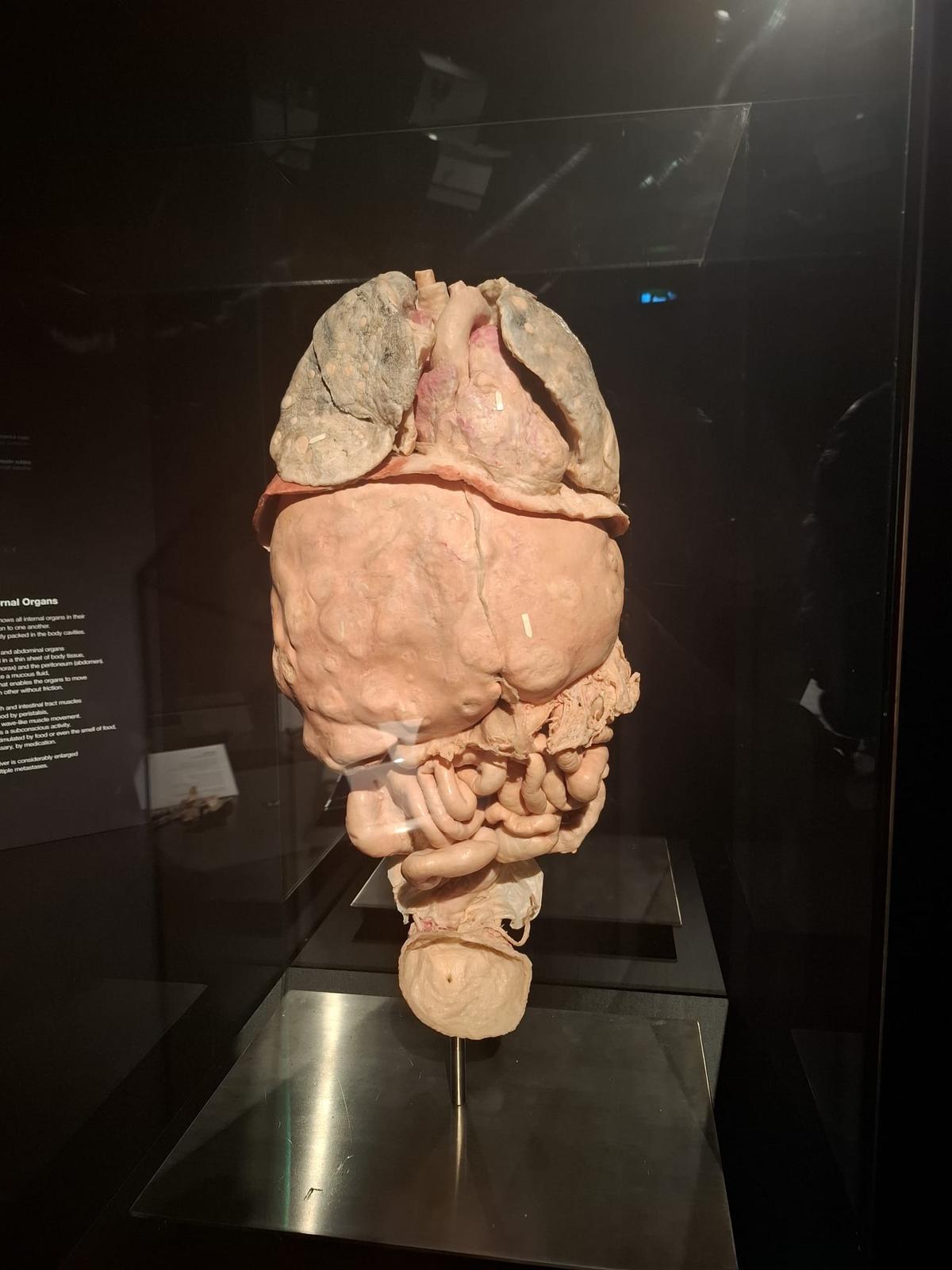 Știință pură și șocantă la București » Controversata expoziție de cadavre plastinate „BODY WORLDS Vital” prezintă corpul omenesc în cele mai mici amănunte, cu exemple din lumea sportului