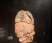 Expoziția Body Worlds Vitals de la București