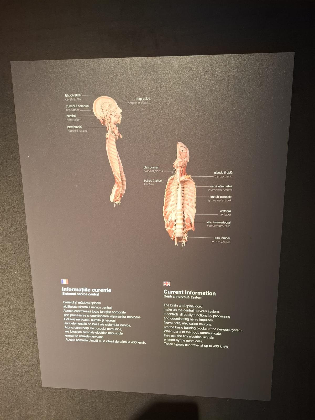 Expoziția Body Worlds Vitals de la București