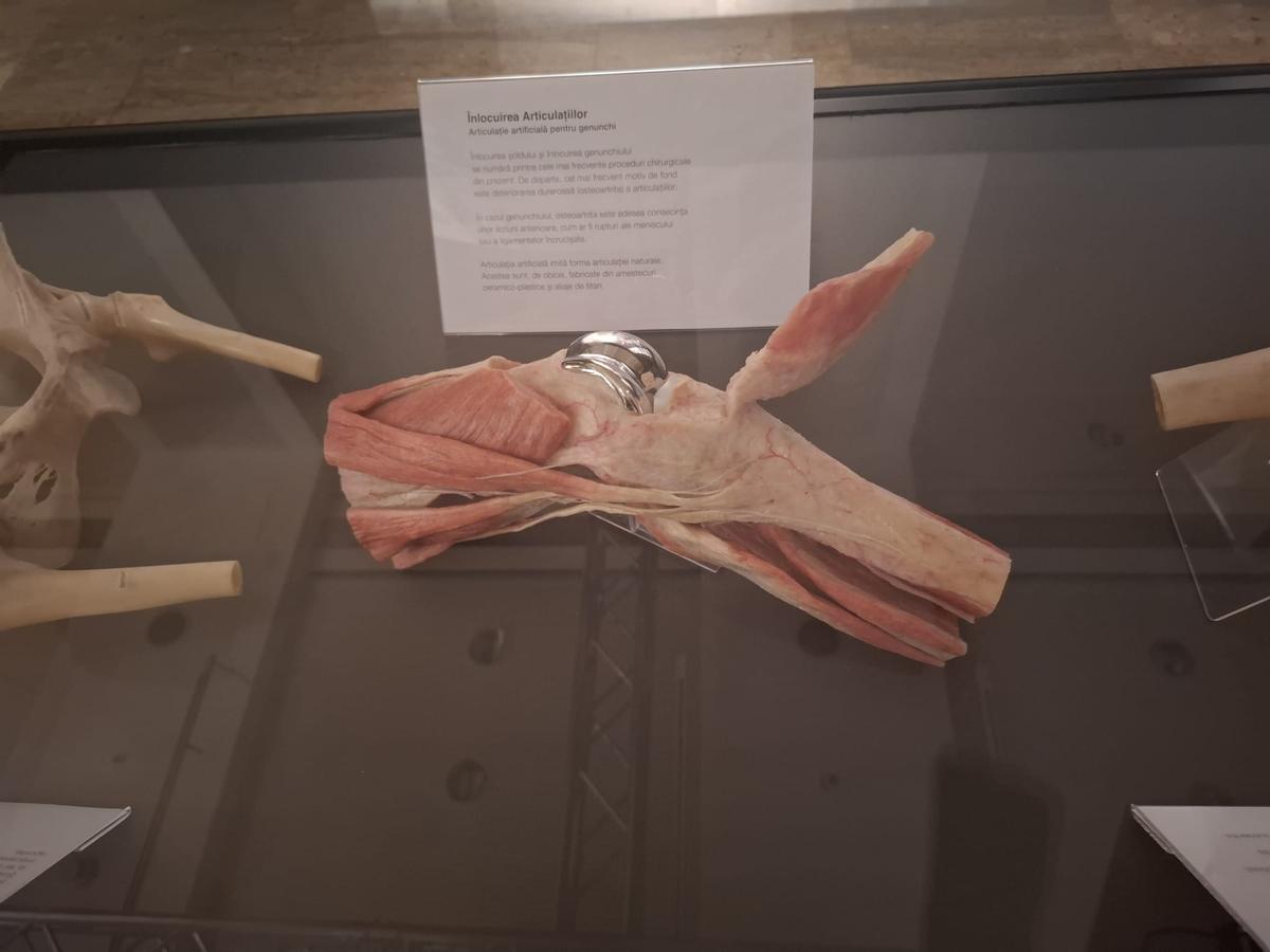 Expoziția Body Worlds Vitals de la București
