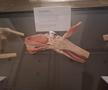 Știință pură și șocantă la București » Controversata expoziție de cadavre plastinate „BODY WORLDS Vital” prezintă corpul omenesc în cele mai mici amănunte, cu exemple din lumea sportului
