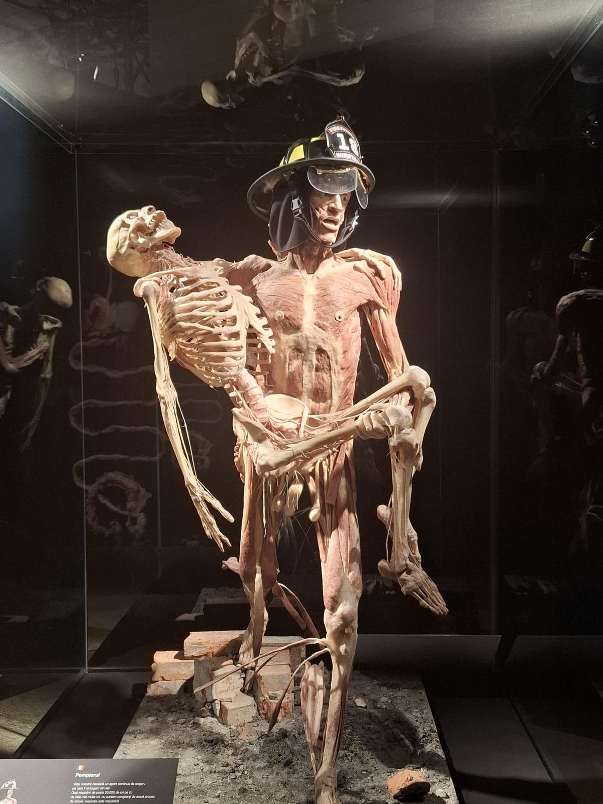 Știință pură și șocantă la București » Controversata expoziție de cadavre plastinate „BODY WORLDS Vital” prezintă corpul omenesc în cele mai mici amănunte, cu exemple din lumea sportului
