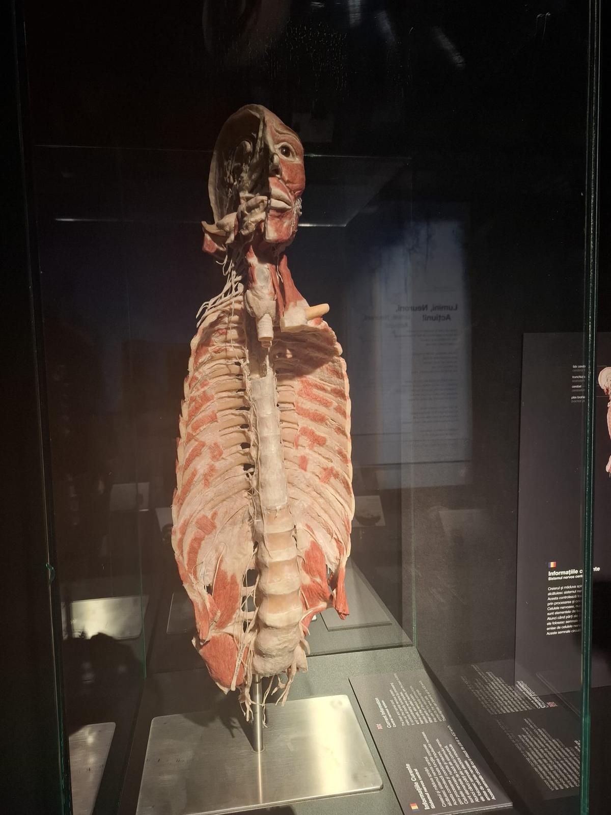 Știință pură și șocantă la București » Controversata expoziție de cadavre plastinate „BODY WORLDS Vital” prezintă corpul omenesc în cele mai mici amănunte, cu exemple din lumea sportului