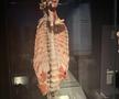 Știință pură și șocantă la București » Controversata expoziție de cadavre plastinate „BODY WORLDS Vital” prezintă corpul omenesc în cele mai mici amănunte, cu exemple din lumea sportului