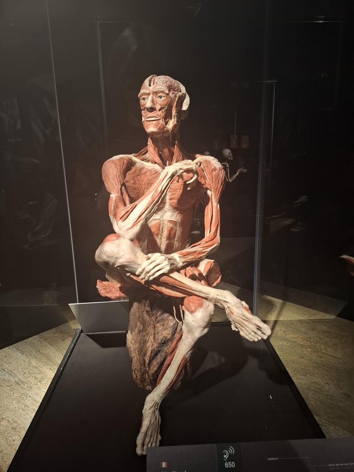 Știință pură și șocantă la București » Controversata expoziție de cadavre plastinate „BODY WORLDS Vital” prezintă corpul omenesc în cele mai mici amănunte, cu exemple din lumea sportului
