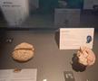 Știință pură și șocantă la București » Controversata expoziție de cadavre plastinate „BODY WORLDS Vital” prezintă corpul omenesc în cele mai mici amănunte, cu exemple din lumea sportului