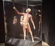 Știință pură și șocantă la București » Controversata expoziție de cadavre plastinate „BODY WORLDS Vital” prezintă corpul omenesc în cele mai mici amănunte, cu exemple din lumea sportului
