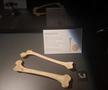 Expoziția Body Worlds Vitals de la București