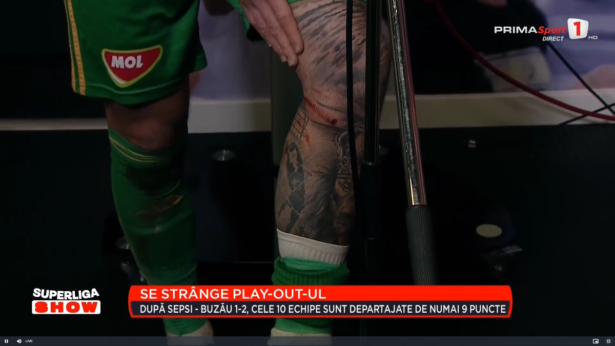 Cum arată piciorul lui Niczuly, după contactul cu Luckassen