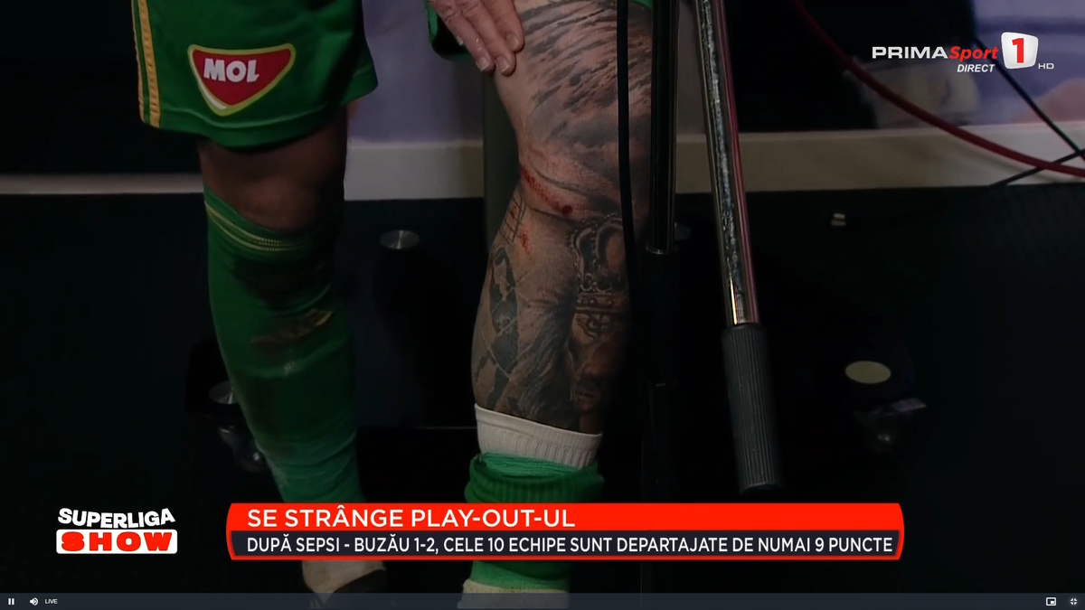 Cum arată piciorul lui Niczuly, după contactul dur cu Luckassen: „Aproape mi-a rupt genunchiul, iar domnul Avram spune că a fost o mică controversă”