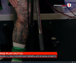 Cum arată piciorul lui Niczuly, după contactul cu Luckassen, foto: captură Prima Sport