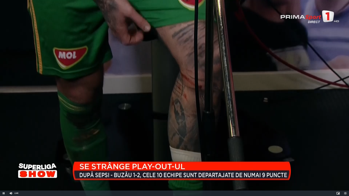 Cum arată piciorul lui Niczuly, după contactul cu Luckassen