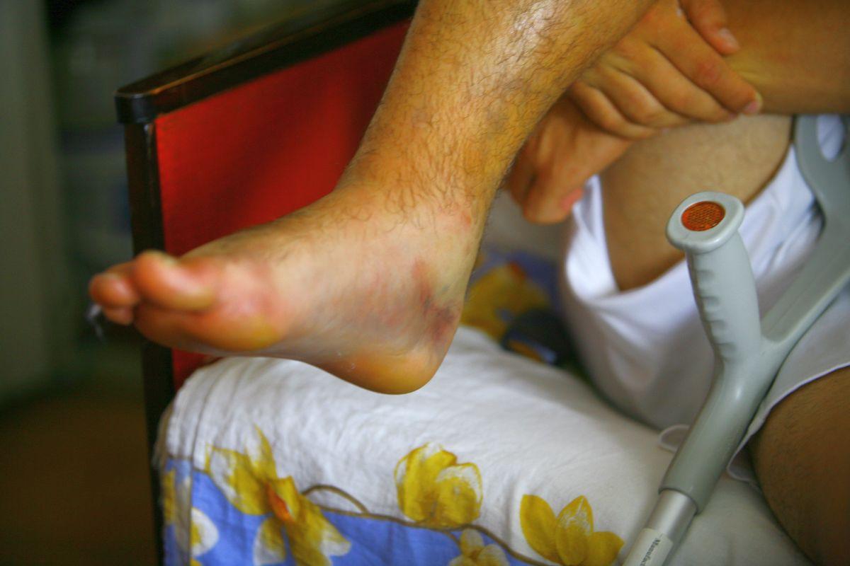 Monel Cârstoiu - imagini cu fostul mijlocaș al Argeșului, accidentat grav de Alex Pițurcă în 2008