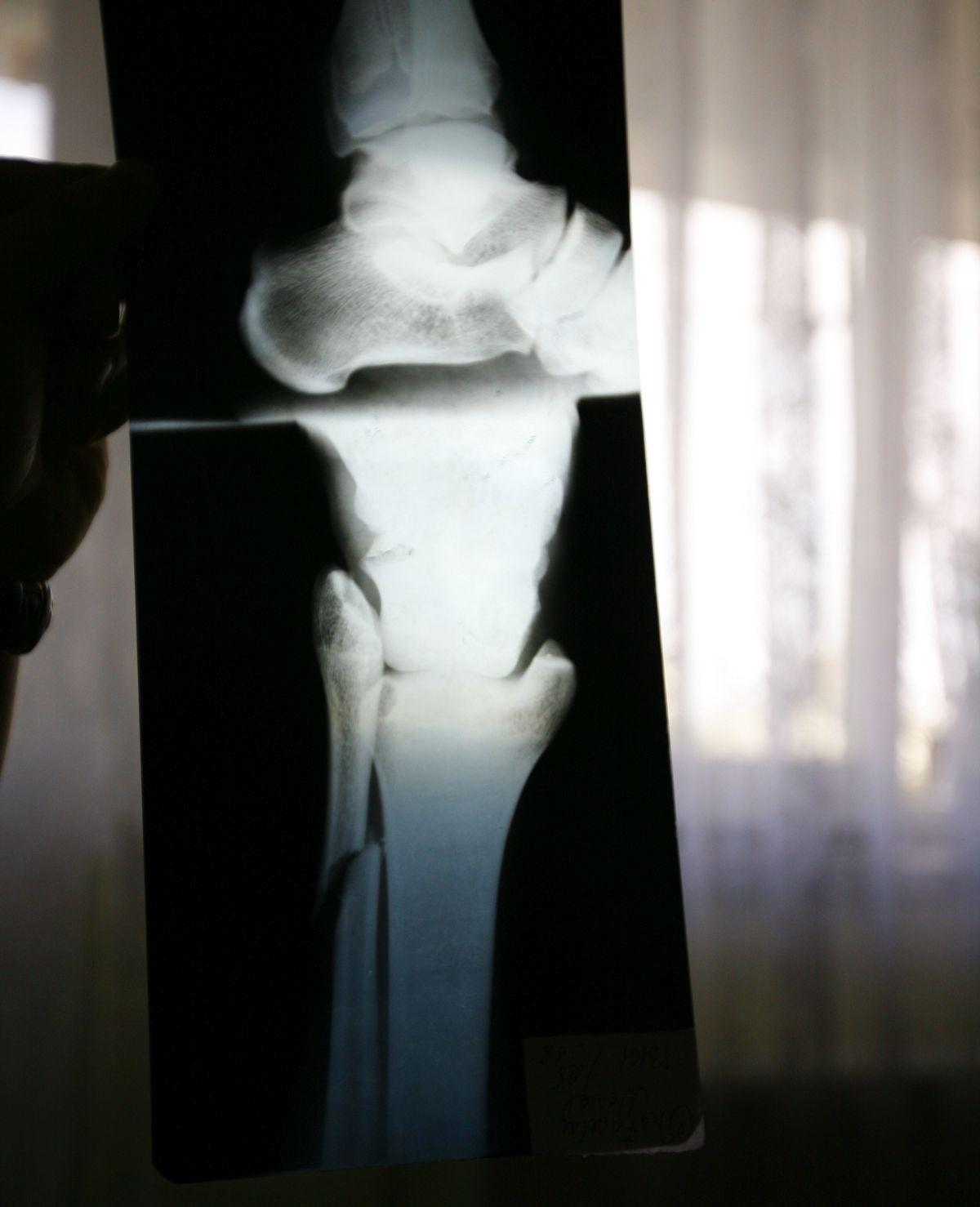 Monel Cârstoiu - imagini cu fostul mijlocaș al Argeșului, accidentat grav de Alex Pițurcă în 2008